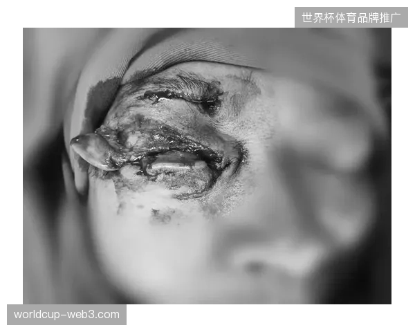 东道主加拿大队遭遇沉重打击，22岁新星弗洛雷斯因前十字韧带撕裂的重伤告别本土世界杯